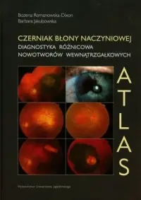Ostatnia szansa Czerniak błony naczyniowej. Diagnostyka różnicowa nowotworów wewnątrzgałkowych. Atlas