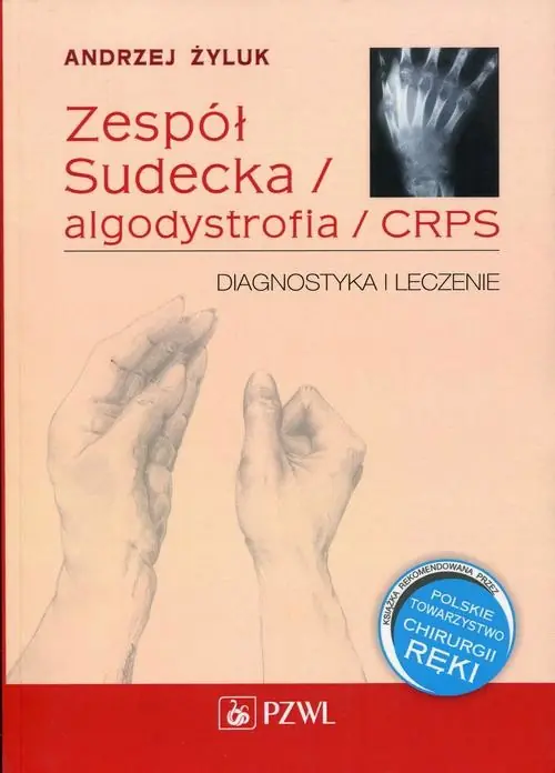 Zespół Sudecka / Algodystrofia / CRPS Ostatnia szansa