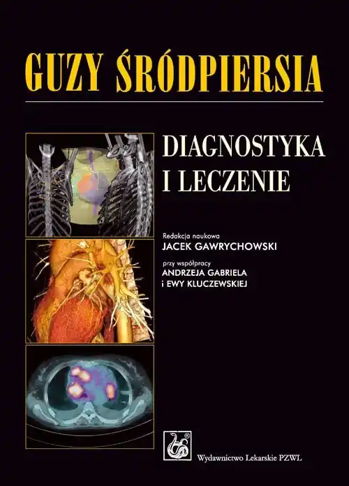 Sprawdź teraz Guzy śródpiersia. Diagnostyka i leczenie