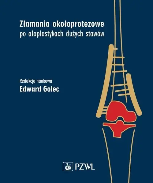 Dostępne od ręki Złamania okołoprotezowe po aloplastykach dużych stawów