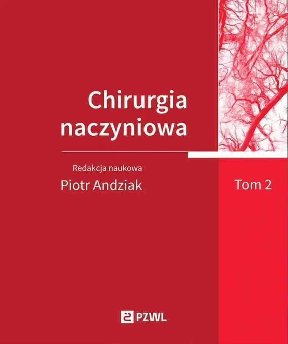 Chirurgia naczyniowa T. 2 Popularny
