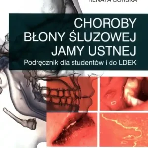 Wyprzedaż Choroby błony śluzowej jamy ustnej